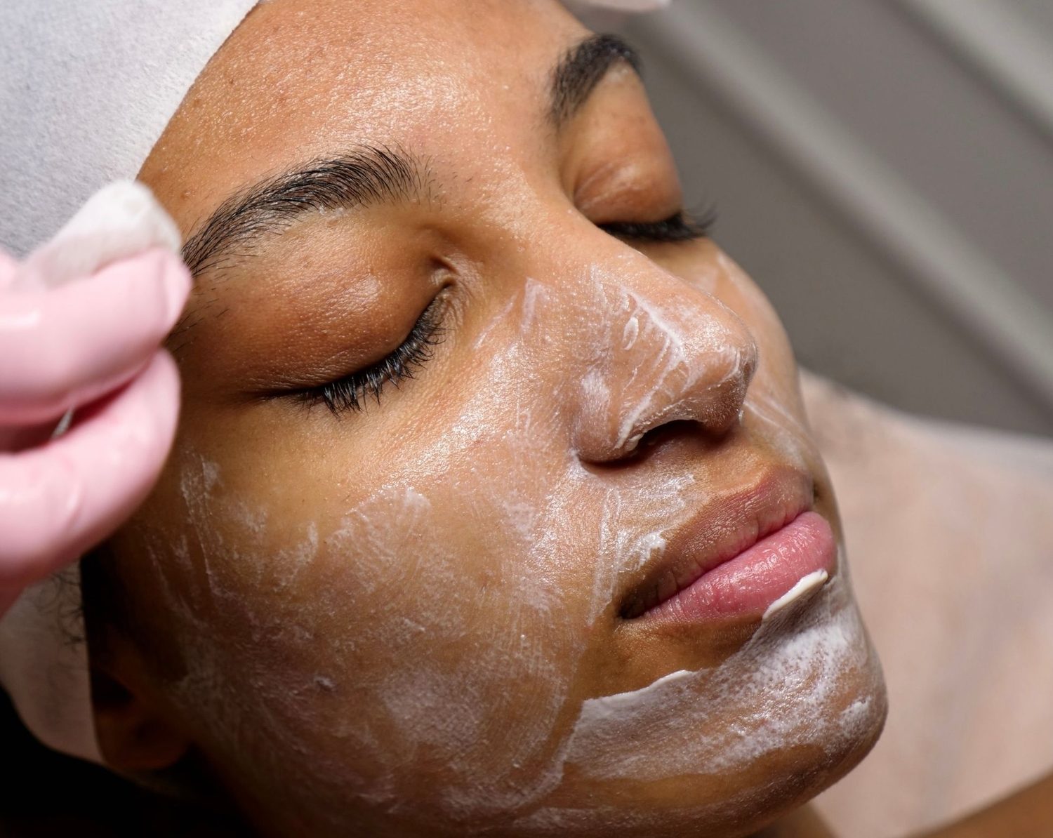 Resultado de limpieza facial profunda en Ziba